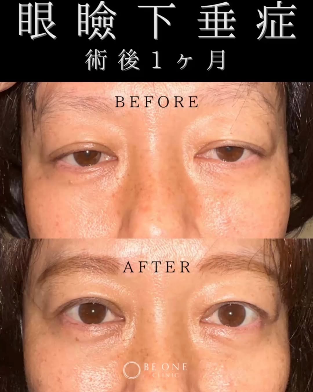 インスタグラムテスト